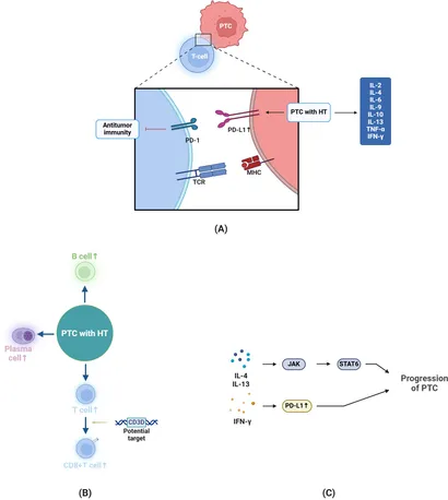 Frontiers | Papillary thyroid carcinoma with Hashimoto's