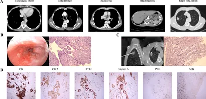 Frontiers | Case report: Long-term survival in synchronous