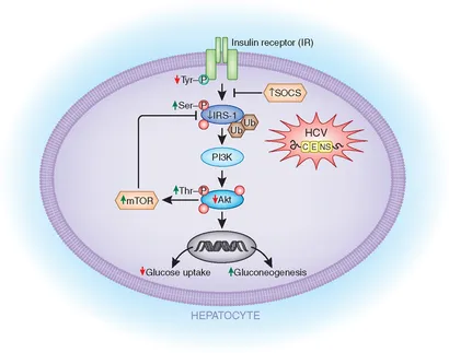 Frontiers | Diabetes and Hepatitis C: A Two-Way Association