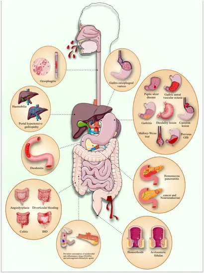 Frontiers | Risk stratification and scoring systems in upper and
