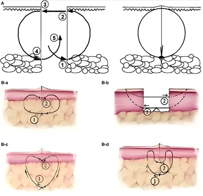 PINKU様 Frontiers | Progress in tension-relieving suturing surgery