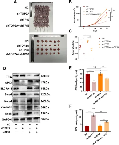 Frontiers | Knockdown of TOP2A reverses cisplatin resistance in