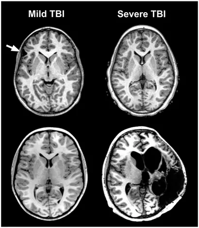 健康・医学 DIAGNOSTIC IMAGING BRAIN Diagnostic Imaging: Brain: 9780323756204: Medicine & Health
