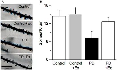 Frontiers | Exercise-Induced Neuroprotection of the