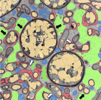 Frontiers | How membranes shape plant symbioses: signaling