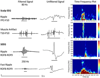  Spin-Related Micro-Photoluminescence in Fe3+ Doped ZnSe