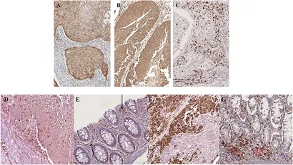 Frontiers | Putative Role of Circulating Human