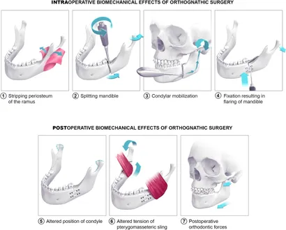 病因論と時間軸で語るBiology-Oriented Dentistry : … 病因論と時間軸で語る Biology-Oriented Dentistry