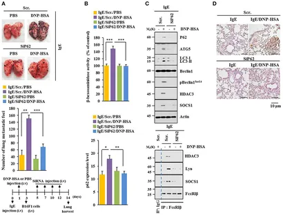 flux rk Mサイズ Frontiers | MiR-135-5p-p62 Axis Regulates Autophagic Flux