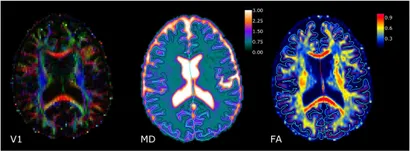 Diffusion tensor imaging metrics associated with future