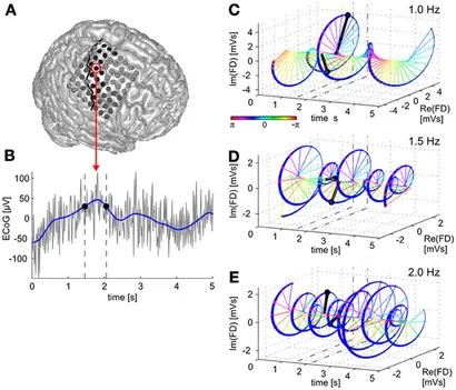 EEG montage with channels indicated. Channel numbers for