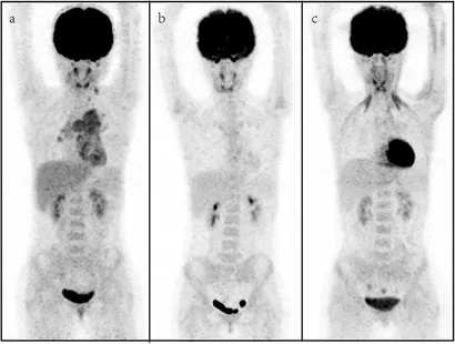 メジカルビュー社｜画像医学・放射線医学｜はじめましてのPET/CT