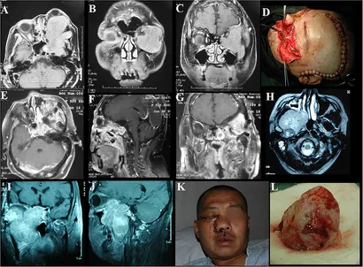 Frontiers | Clinial Features, Individualized Treatment and