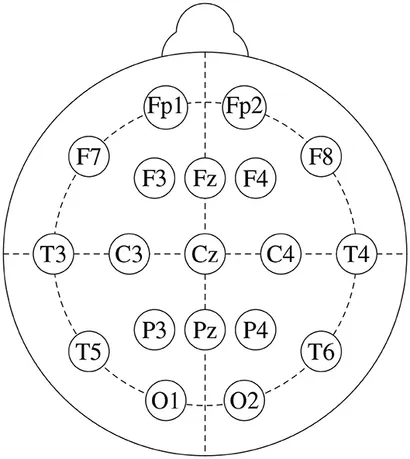 eeg 2006年 A, High-density EEG arrays with 257 channels, down-sampled