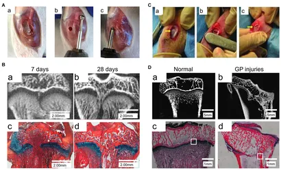 ガム Frontiers | Enlightenment of Growth Plate Regeneration Based