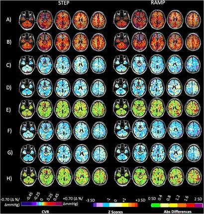 Frontiers | The Reproducibility of Cerebrovascular