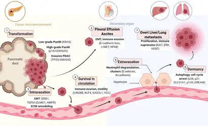 【驚きの値段で】 of Models Pre-clinical | Frontiers Metastasis Pancreatic in その他