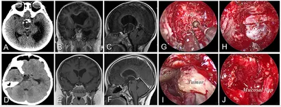 小児神経の画像診断 = Diagnostic Imaging of Infan…