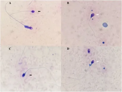 その他 TK White Adipocyte Stem Cell Expansion Through Infant Formula