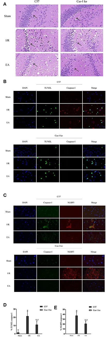 Frontiers | Mechanism of Electroacupuncture Against Cerebral