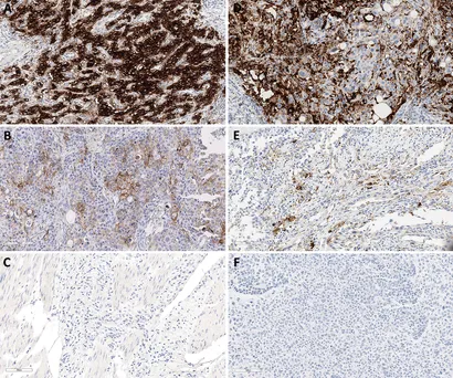 Safety and dose escalation of the targeted oncolytic