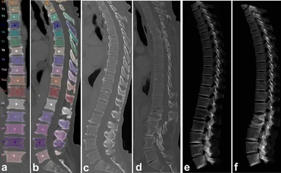 健康・医学 Spinal control fendo-13-882163-g001.jpg