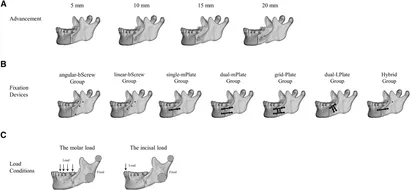 fsurg-09-891747-g001.jpg