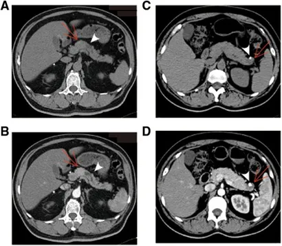Frontiers | Multimodality imaging differentiation of