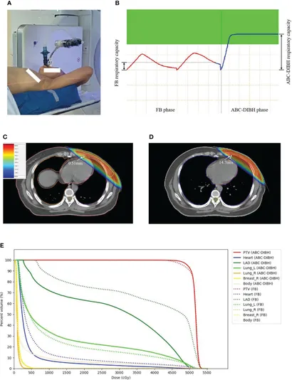 Frontiers | The effect of respiratory capacity for dose