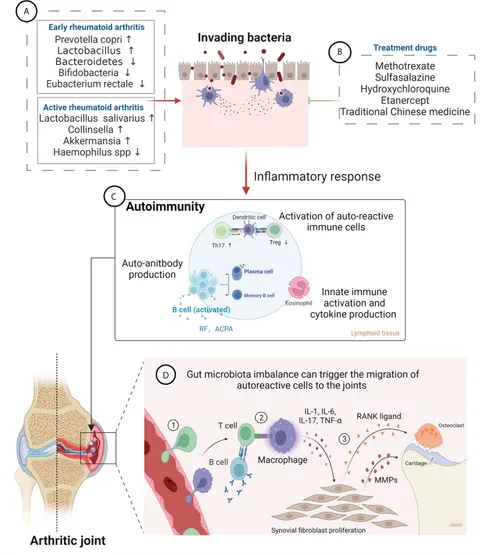 Gastrointestinal and Hepatic Manifestations of Rheumatic