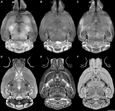 Cranial Magnetic Resonance Imaging 医学書 洋書』 古書・古文書