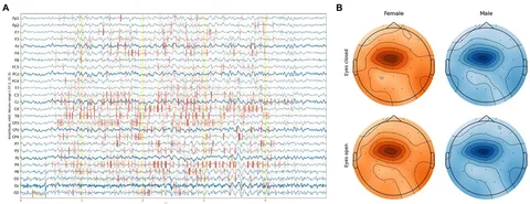 Frontiers | Predicting age from resting-state scalp EEG