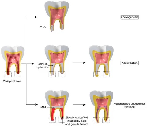 治癒の歯内療法 = BIOLOGY BASED ENDODONTICS : エ… 治癒の歯内療法 = BIOLOGY BASED ENDODONTICS : エ…