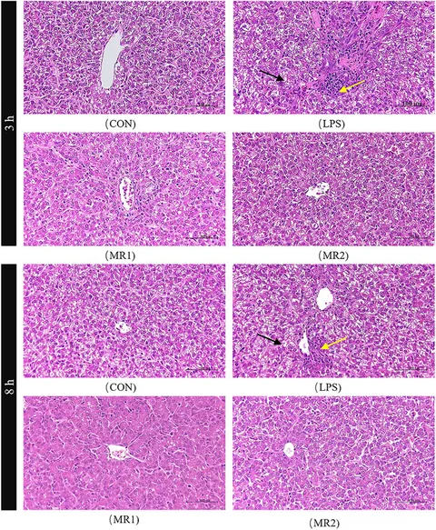Frontiers | Dietary methionine restriction alleviates