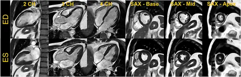 Cardiovascular Magnetic Resonance Imaging (Contemporary
