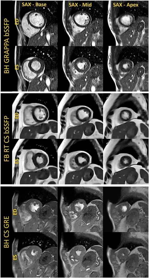Cardiovascular Magnetic Resonance Imaging (Contemporary