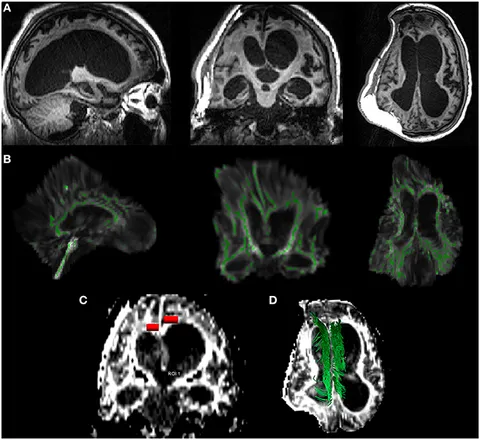 Introduction to Diffusion Tensor Imaging: 9780444528285