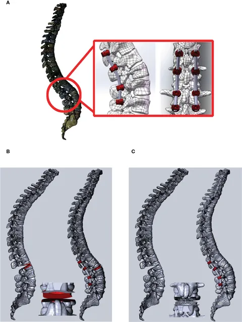脊椎脊髄病学 = PRINCIPLES OF SPINAL DISORDERS 脊椎脊髄病学 = PRINCIPLES OF SPINAL DISORDERS Spinal Cord