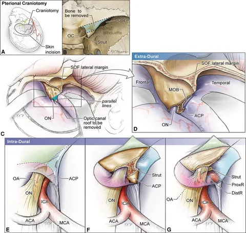 Frontiers | Comprehensive microsurgical anatomy of the Frontiers | Comprehensive microsurgical anatomy of the