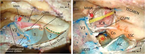 Frontiers | Comprehensive microsurgical anatomy of the