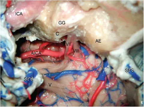 fsurg-10-1132784-g008.jpg
