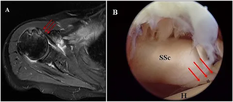 健康・医学 MRI ARTHROSCOPY and SURGICAL ANATOMY Amazon | Mri, Arthroscopy, and Surgical Anatomy of the