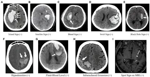 Frontiers | Research advances in imaging markers for