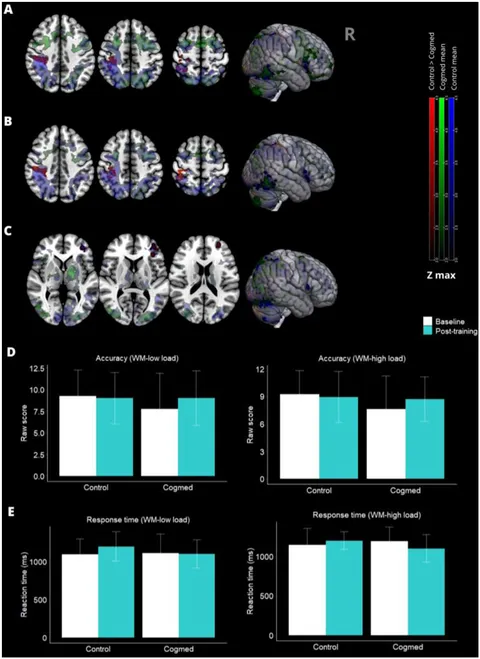 Frontiers | Computerized working memory training for Frontiers | Computerized working memory training for