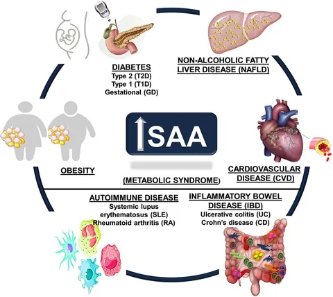 Frontiers | Serum amyloid A and metabolic disease: evidence
