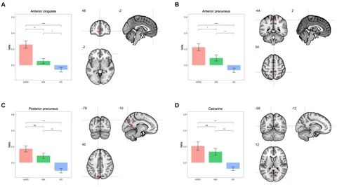 Frontiers | Neuroimaging markers of Alice in Wonderland