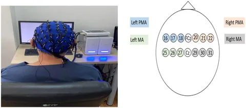 eeg 2008年 Circumscribed Midline EEG Activity in Neurologically Normal