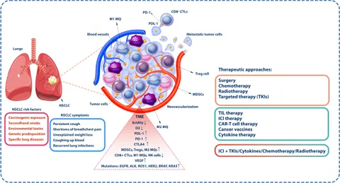 Innovative Treatment Strategies for Relapsed Extensive Stage Small Cell Lung Cancer