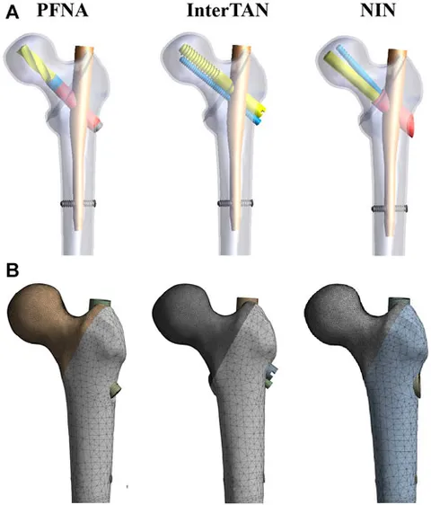 Frontiers | Biomechanical evaluation of a new intramedullary Frontiers | Biomechanical evaluation of a new intramedullary