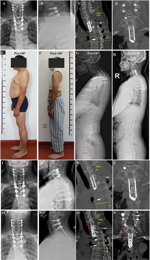 THINK Surgical, Inc. Receives CE Mark Approval for the